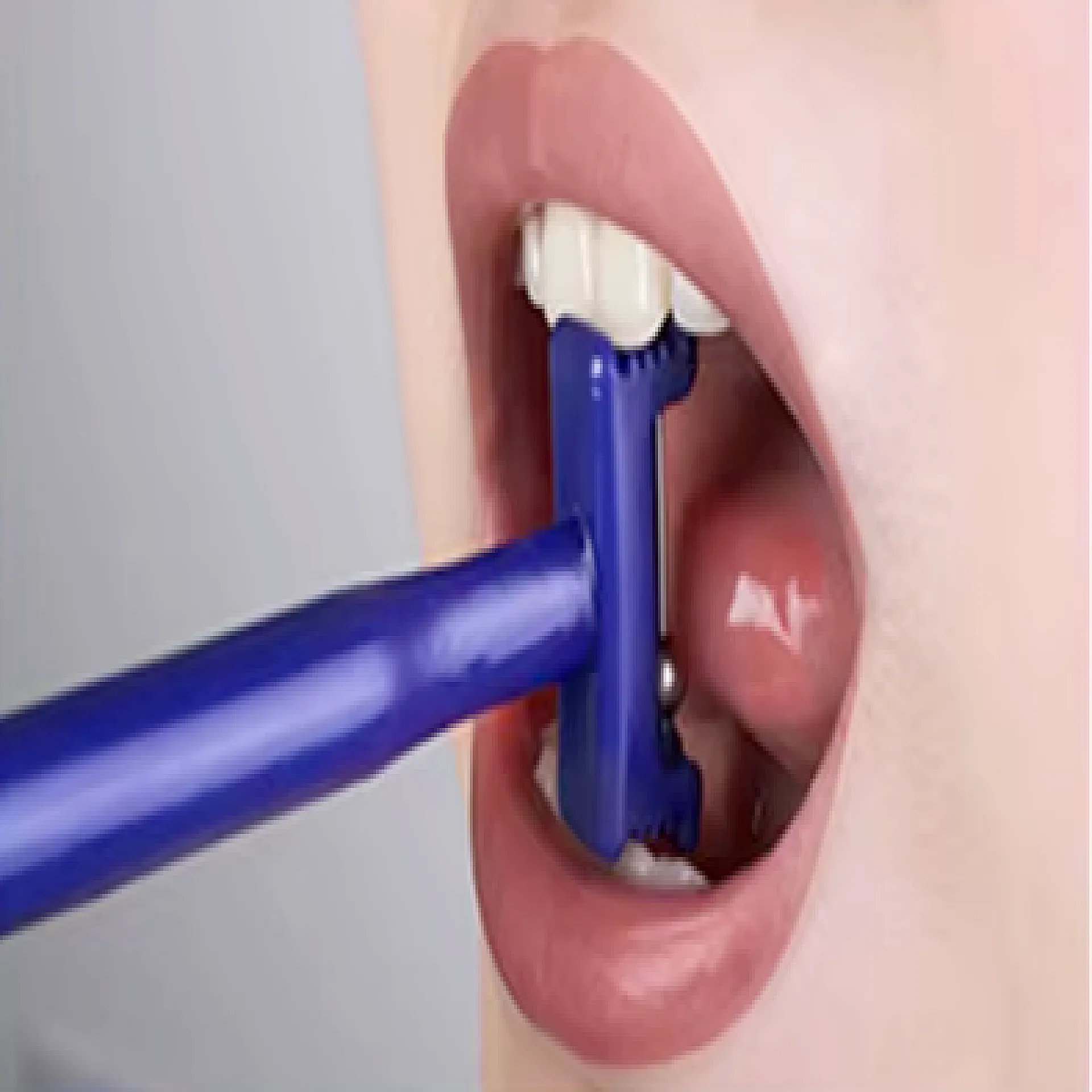 מאמן לסת וצינור טיפולי