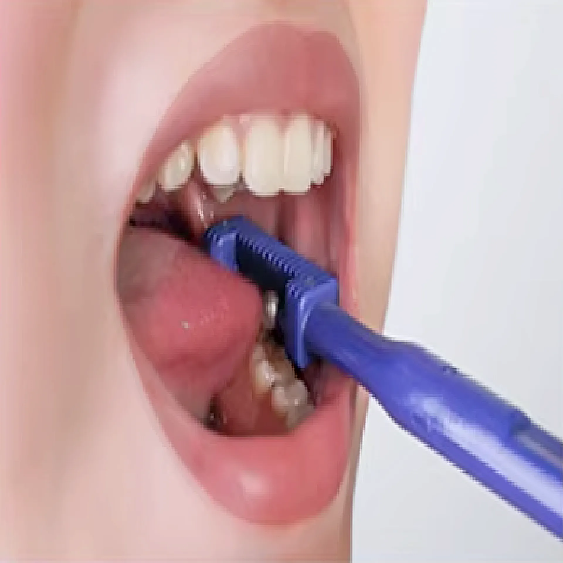 מאמן לסת וצינור טיפולי