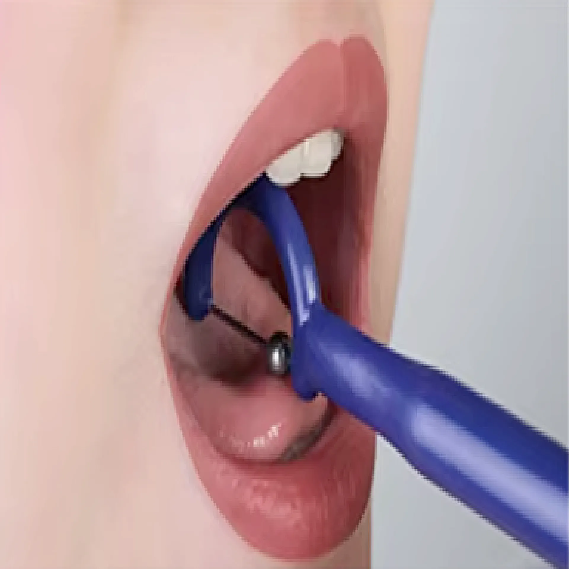 מאמן לסת וצינור טיפולי